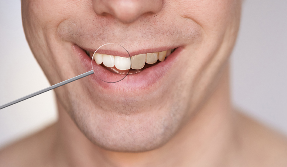 Whiter Brighter Smile Possible With Teeth Whitening