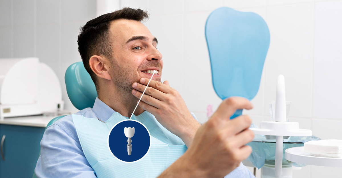 What Can You Expect During Dental Implant Placement?