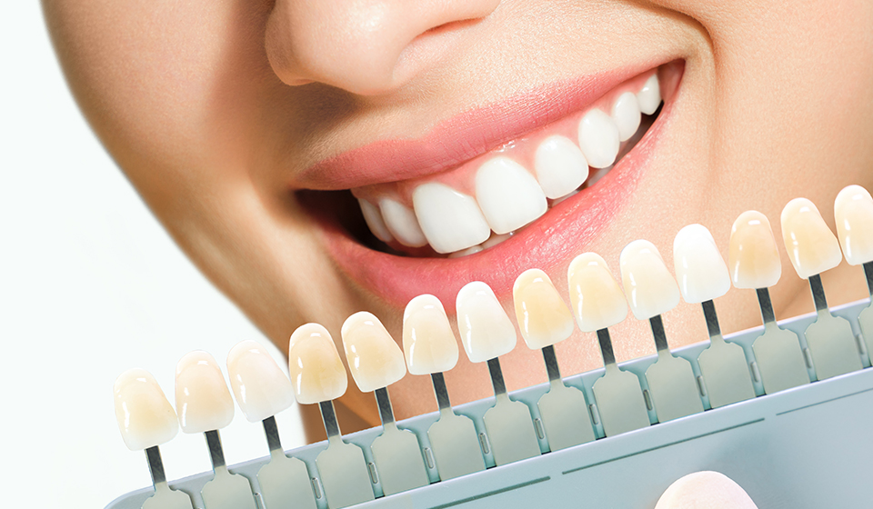 5 Major Ways Porcelain Veneers Can Transform Your Smile