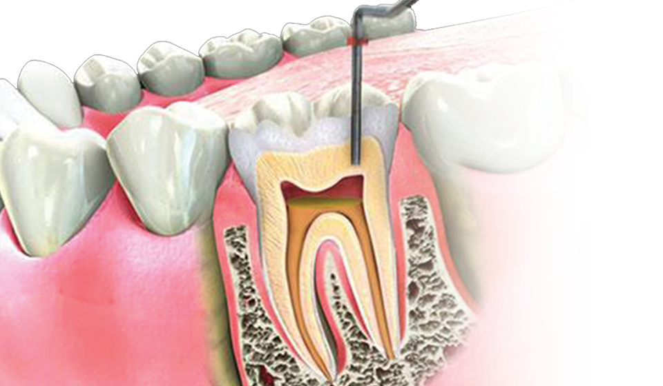 What to Expect at Your First Endodontics Appointment in New York