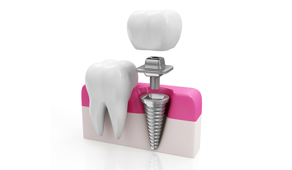 Modern Dental of Manhattan in New York