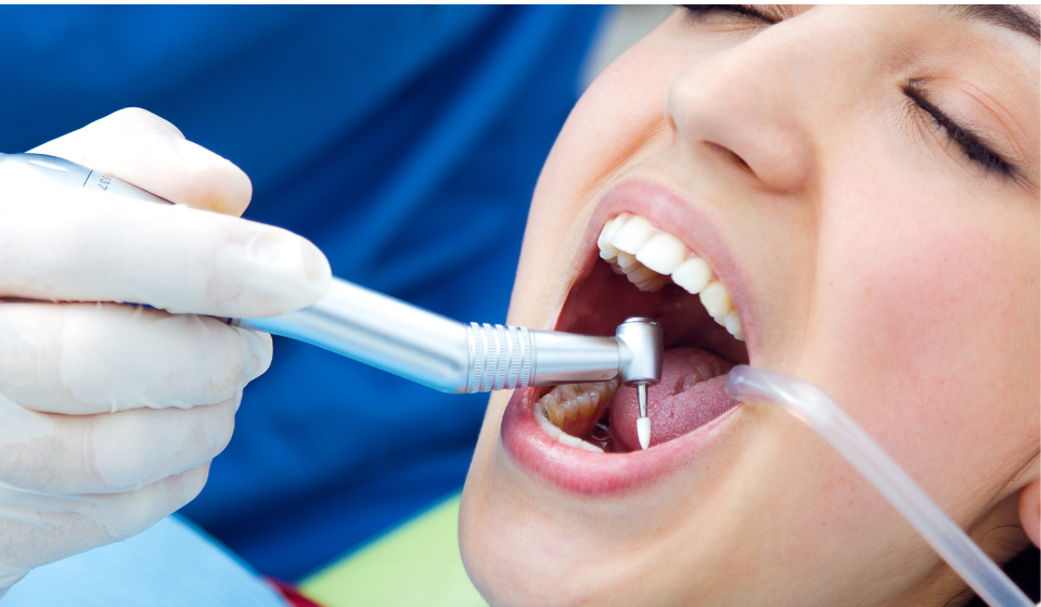 How Professional Dental Cleaning Improves Smile Appearance