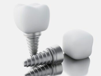 Dental Implants in New York