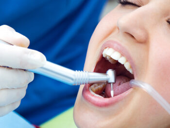 Periodontal Treatment