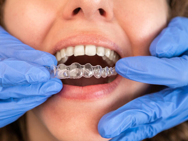 Invisalign in New York