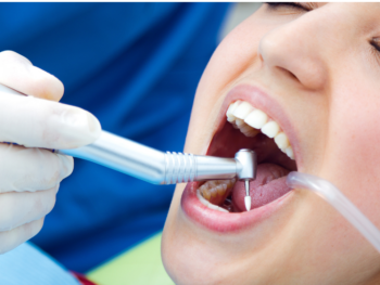 Professional Dental Cleaning