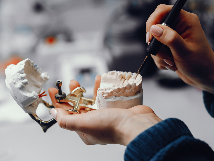 Dental Implants