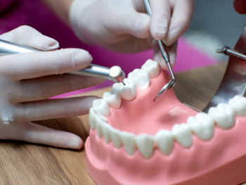 Dental Crowns